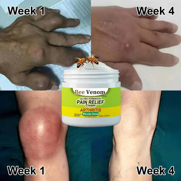 Bee Venom Ultra Strength Pain Relief Cream - (🔥BUY 1 GET 2 FREE🔥. (Today Offer Only)
