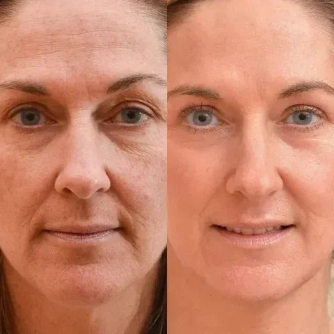 Botox Anti-Aging Serum, Youthfully Botox Face Serum(Pack Of 1)